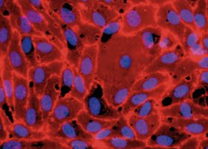 Human Umbilical Vein Endothelial Cells